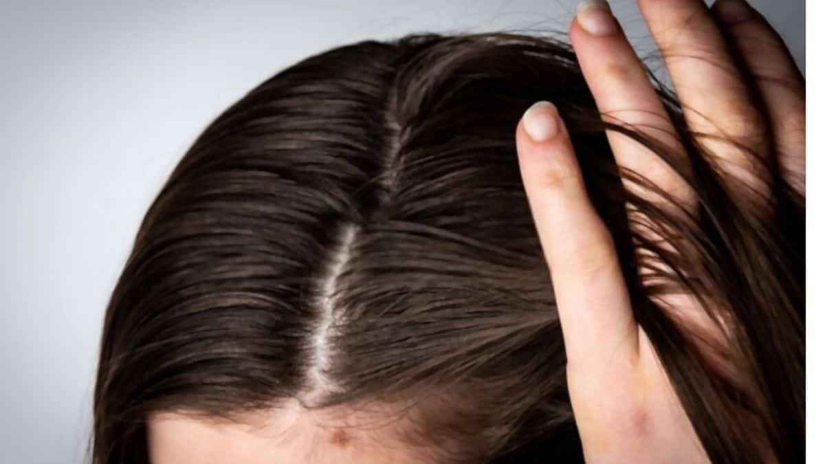 How to Hide Thinning Hair: Tips and Tricks for a Confident Look